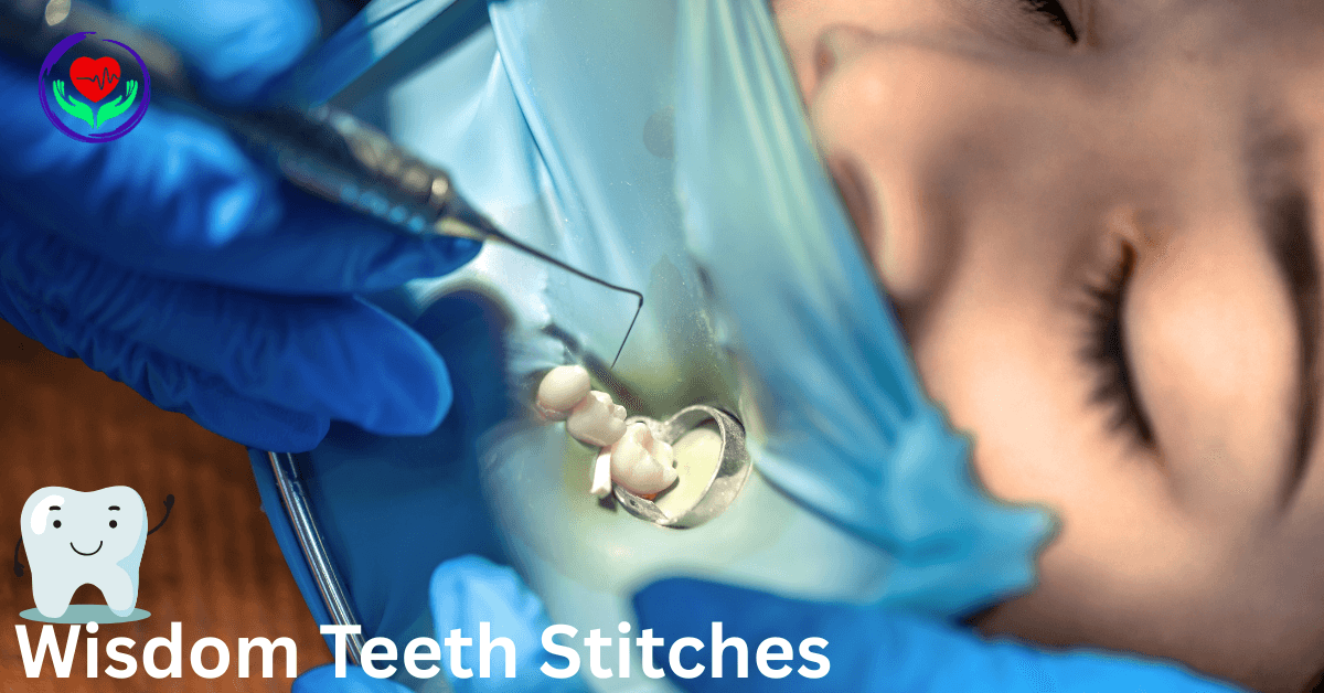 Wisdom Teeth Stitches: Healing Time, Care Tips, and What to Expect more After Removal