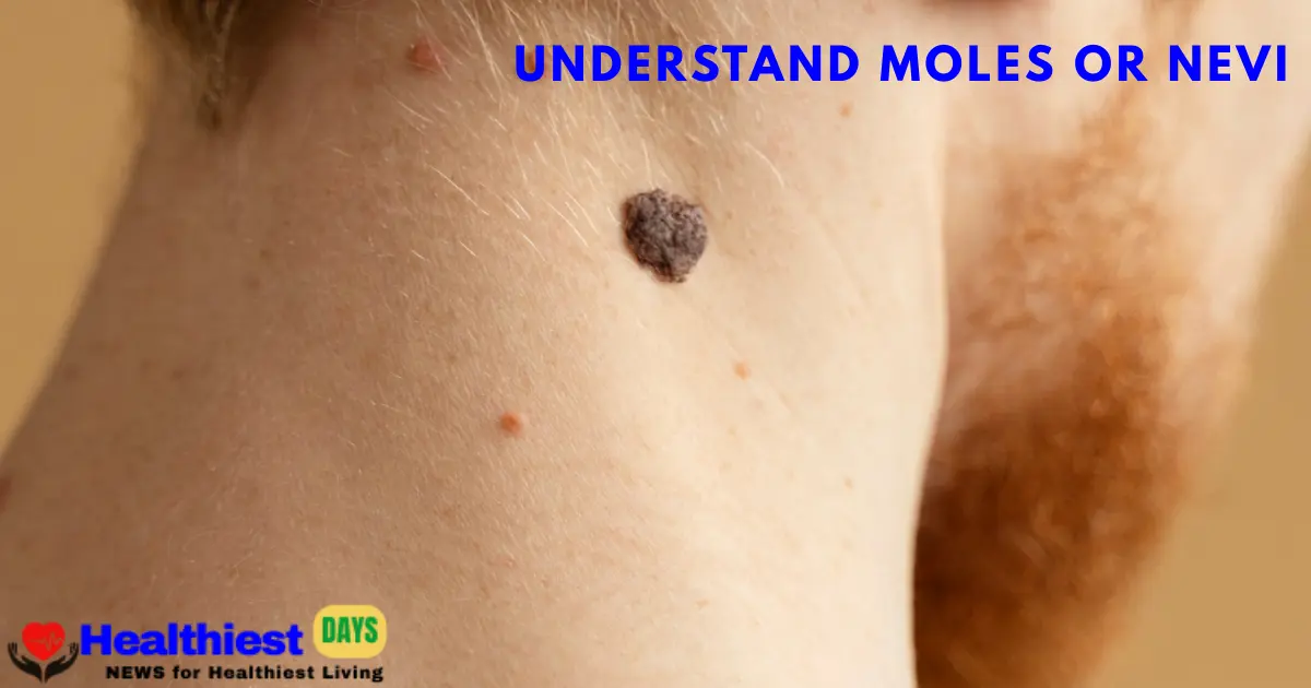 Why the question “Can removing a mole cause cancer?” Matters